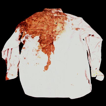 at least 1 bullethole too low to match a throat exit wound