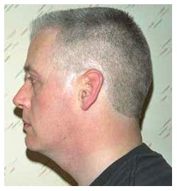 Classic flattop - photo 2