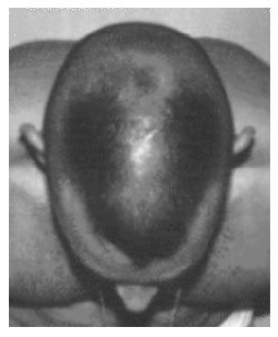 Horseshoe flattop with a long, thin landing strip