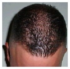 High and tight - top