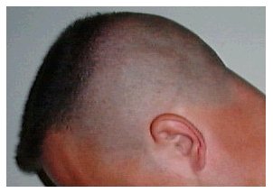 High and tight - left