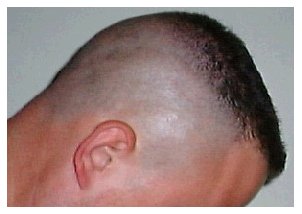 High and tight - right