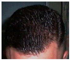 Regulation cut - top