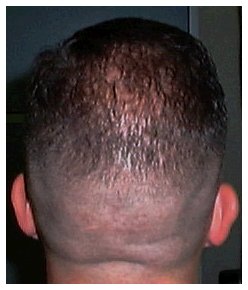 Regulation cut - back