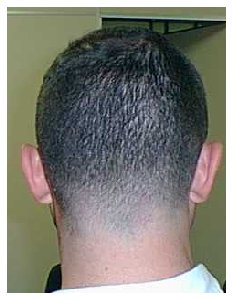 Businessman's cut - back