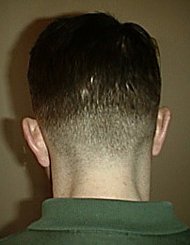 After - back view