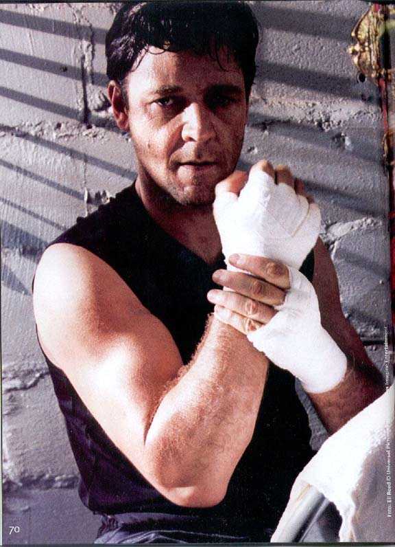 Jim con vendas en las manos (Jim with bandages in his hands) 