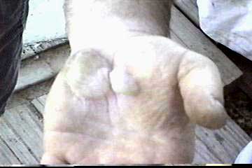 Steve's hand, Ouch!!!    11kb