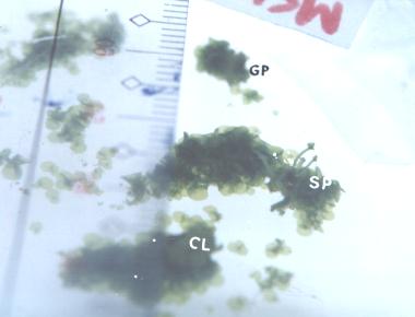 Figure 13. Pteris vittata gametophyte clumping (GP), callus (CL) and sporophyte (SP)
