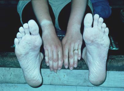 Sore, tired & WET feet! 