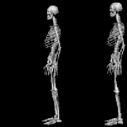 skeleton kicking skeleton