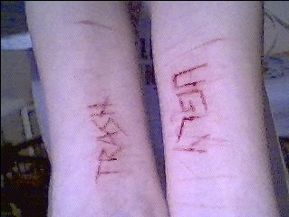 my newer cuts and some old faded scars