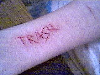 you can see the big scar in the upper right corner...i did that at my exs place...it was pretty deep...he really hurt me that night