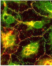 Gap junction protein assembly and trafficking. Coronaviral spike protein trafficking