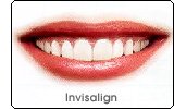 Invisalign