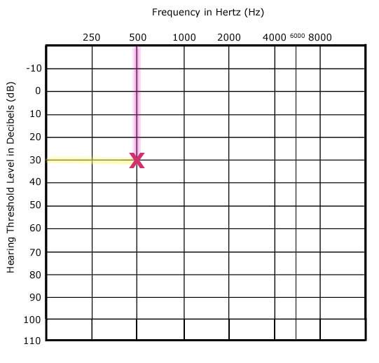 How to Read an Audiogram The Basics