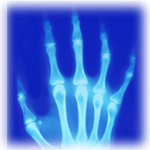 X-Ray of the Hand