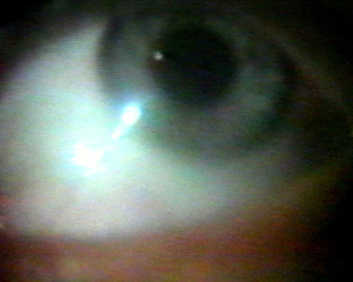 eyes.jpg (63191 bytes)