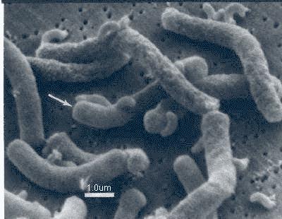 Bdellovibrio bacteriovorus attacking Spirillum serpens