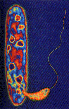 Bdellovibrio bacteriovorus attacking Pseudomonas
