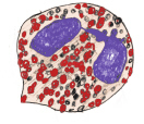 eosinophiler Granulozyt