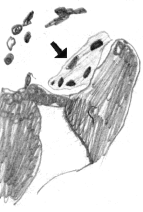 Osteoklast