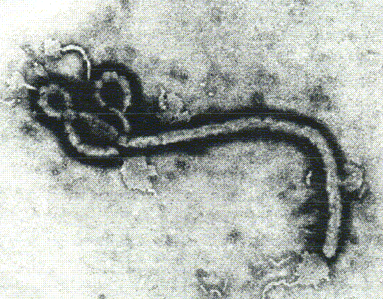 Ebola v�rus