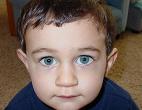 green eyes