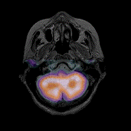 NEUROCIENCIAS