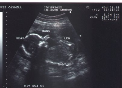 Me as a "PEANUT" inside Mommy's Tummy
