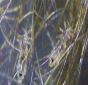 live lice crawling through hair