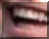 Nice teeth