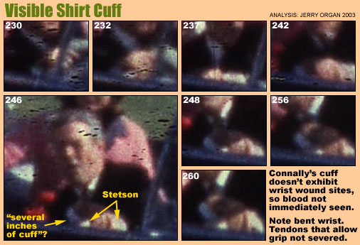 Shirt Cuff