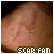 Fan of Harry Potter's Lightening Bolt Scar