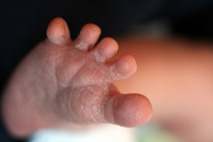 My foot