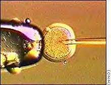 Oocyte enucleation (JPG)