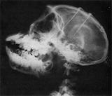 X-ray of implants in monkey's head (JPG)