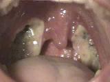 gross-out