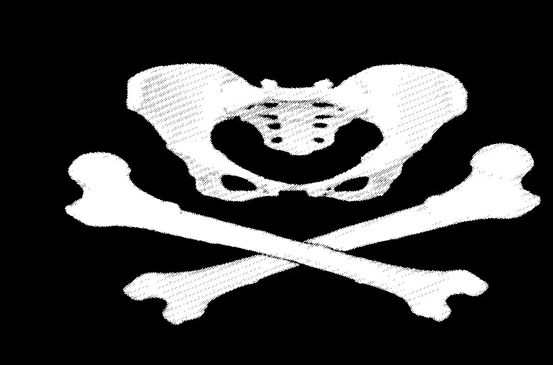 [Pelvis & Crossbones Picture]