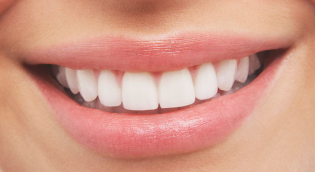 White Teeth