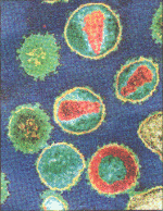 HIV Bug:A third of patients waited more than two weeks to be tested for the virus