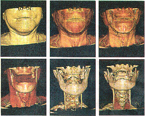 X-ray eyes:The Aquilon 64 can strip away layers of skin and muscle to reveal the skeleton [Pictures:Ferrari]