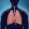 Asthma Treatment Cure Herbal Herbs Medicine Treatment Cure KL Kuala Lumpur