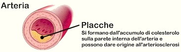Le placche