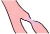 Vasocostrizione