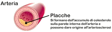 Placche 