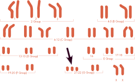 Description: http://www.nads.org/images/photos_articles/chromosomes.gif
