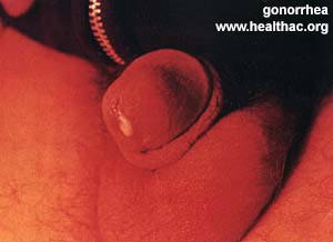 GOMORREA