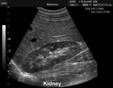 kidneys