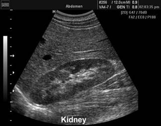 kidneys